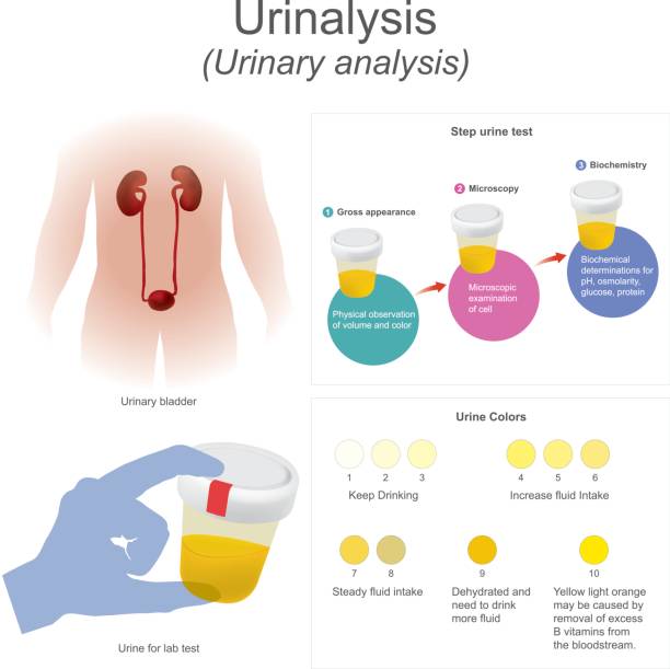 мочеиспускание (анализ мочи) лабораторный тест окунает полосу в мочу, химические реакции меняют цвета. - physical checkup stock illustrations