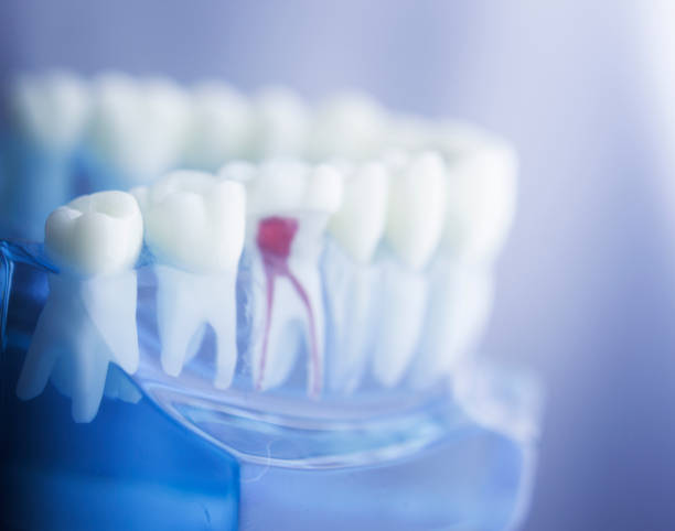 istock Dental tooth dentistry student learning teaching model showing teeth, roots, gums, gum disease, tooth decay and plaque. 846078548
