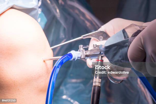 Surgical Operation For Knee Arthroscopy Micro Surgery In Hospital Operating Theater Emergency Room Of Traumatology And Orthopedics Stock Photo - Download Image Now