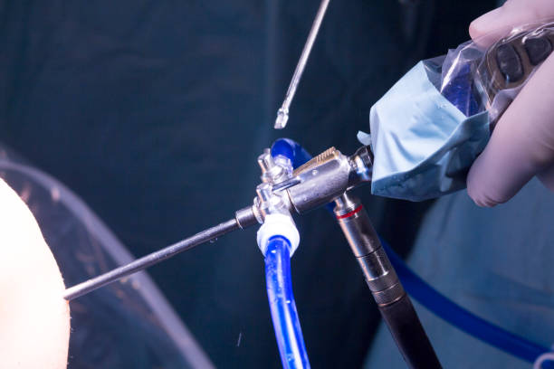 istock Surgical operation for knee arthroscopy micro surgery in hospital operating theater emergency room of traumatology and orthopedics. 846131348