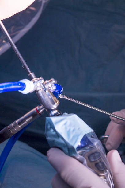istock Surgical operation for knee arthroscopy micro surgery in hospital operating theater emergency room of traumatology and orthopedics. 846131350