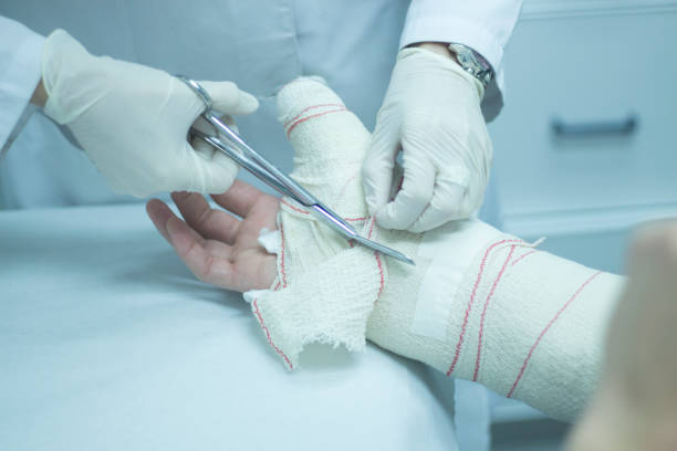 médico aplicando um molde de gesso e curativos para paciente do antebraço e pulso para imobilizar após lesão de fratura. - physical injury hospital cast doctor - fotografias e filmes do acervo