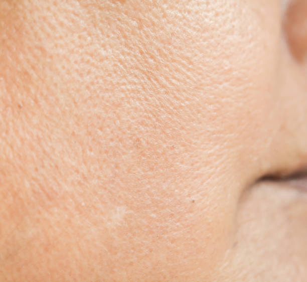 istock Pores on the face in women 846204628