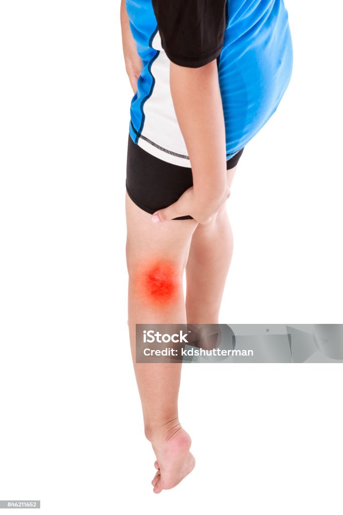 Sports injure. Asian child cyclist injured at thigh. Isolated on white. Conceptual of injure from sport. Child cyclist injured at foldable joint of the leg. Isolated on white background. Studio shot. 8-9 Years Stock Photo