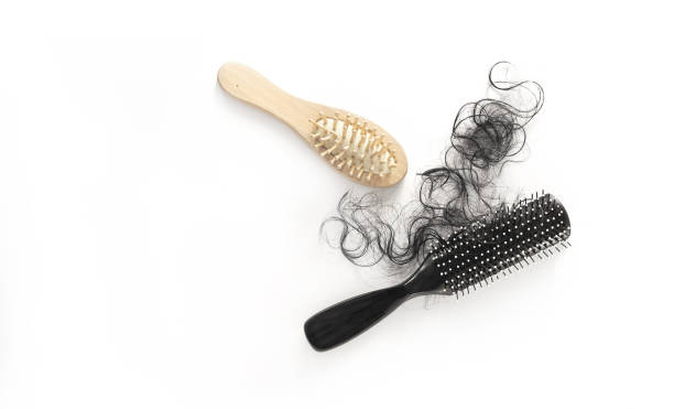 istock Hairs loss fall in comb on white background, blank text 846216990