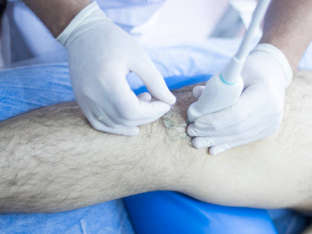 istock Ultrasound assisted EPI ecography intratissue percutaneous electrolysis physical therapy rehabilitation physiotherapist treatment 846322298