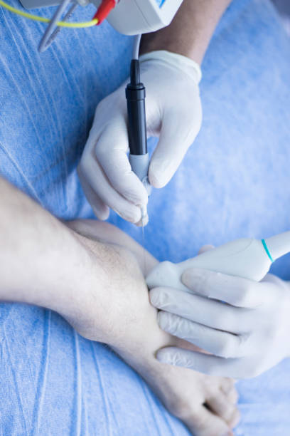 istock Ultrasound assisted EPI ecography intratissue percutaneous electrolysis physical therapy rehabilitation physiotherapist treatment 846322458