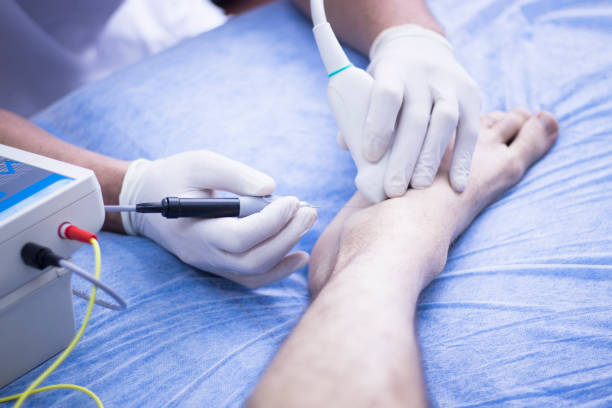 istock Ultrasound assisted EPI ecography intratissue percutaneous electrolysis physical therapy rehabilitation physiotherapist treatment 846322482