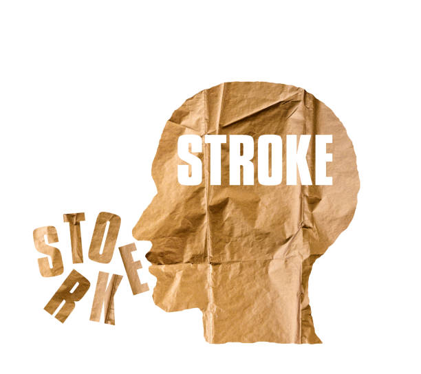 istock Crumpled paper shaped as a human head and STROKE concept on white background. STROKE concept 846347630