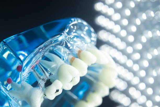 istock Dentists dental teeth teaching model showing each tooth, gum, root, implant, decay, plaque and enamel. 846366864
