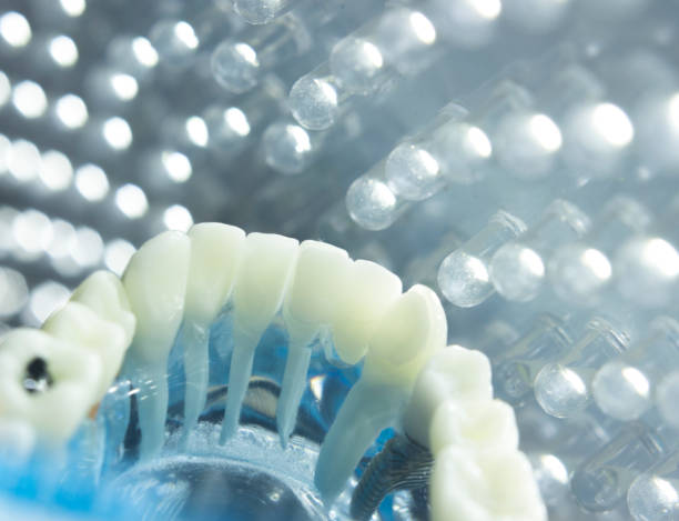 istock Dentists dental teeth teaching model showing each tooth, gum, root, implant, decay, plaque and enamel 846373828