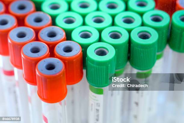 Group Of Medical Sample Tube Stock Photo - Download Image Now - Illness, Laboratory, Acid