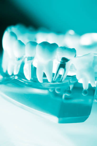 istock Dentists dental teeth teaching model showing each tooth, gum, root, implant, decay, plaque and enamel. 846754724