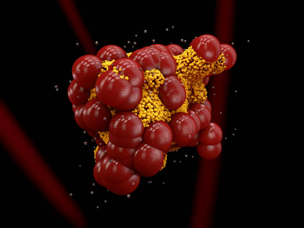 istock atherosclerosis and atherotrombosis. 3d illustration 846767690