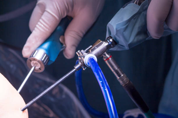 istock Surgical operation for knee arthroscopy micro surgery in hospital operating theater emergency room of traumatology and orthopedics. 846777988