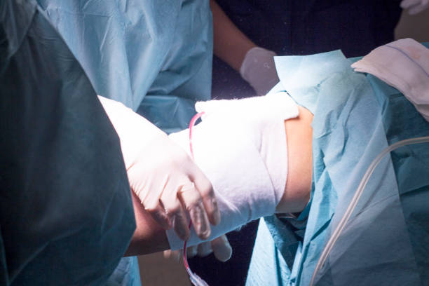 istock Surgical operation for knee arthroscopy micro surgery in hospital operating theater emergency room of traumatology and orthopedics. 846778148