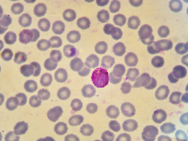 Malaria parasite Red blood cell infected with malaria parasite (gametocyte stage) malaria blood sample stock pictures, royalty-free photos & images