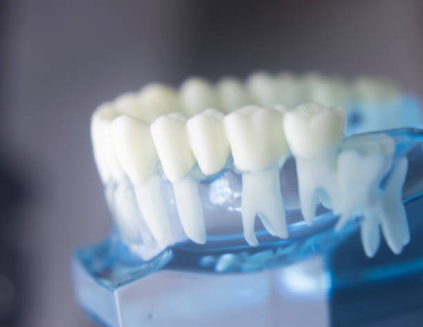 istock Dental tooth dentistry student learning teaching model showing teeth, roots, gums, gum disease, tooth decay and plaque. 846896142