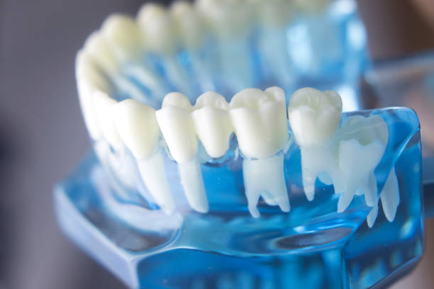 istock Dental tooth dentistry student learning teaching model showing teeth, roots, gums, gum disease, tooth decay and plaque. 846896152