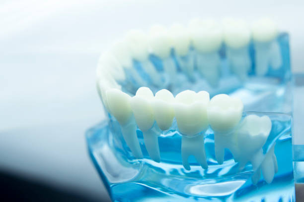 istock Dental tooth dentistry student learning teaching model showing teeth, roots, gums, gum disease, tooth decay and plaque. 846933066