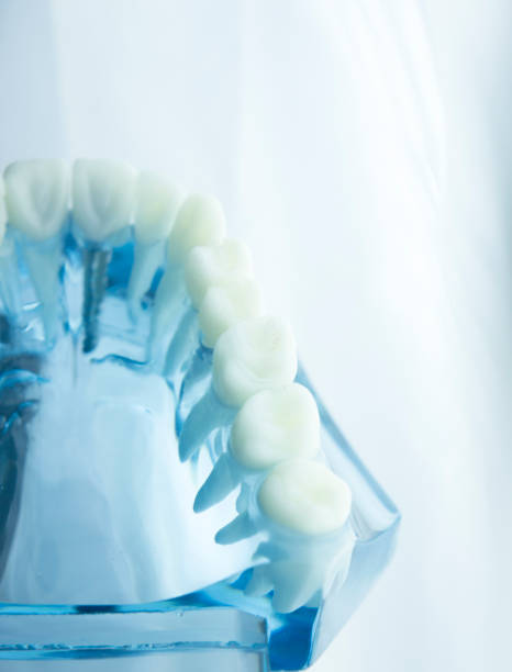 istock Dental tooth dentistry student learning teaching model showing teeth, roots, gums, gum disease, tooth decay and plaque. 846933080