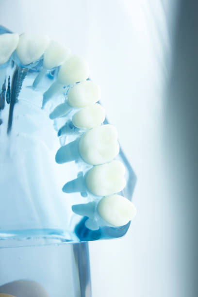 istock Dental tooth dentistry student learning teaching model showing teeth, roots, gums, gum disease, tooth decay and plaque. 846934492