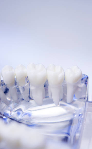 istock Dentists tooth plastic model used for teaching, learning and patient consultations in dental office showing teeth and gums. 846945226