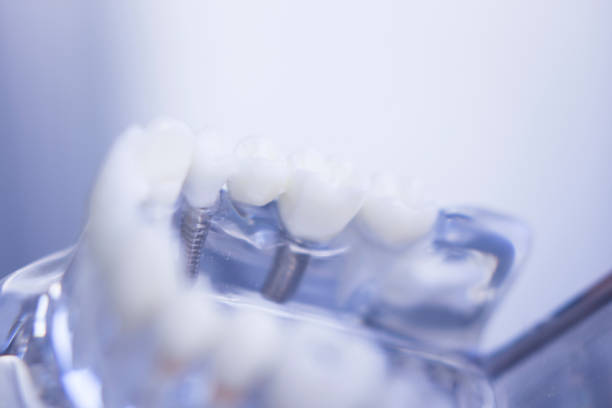 istock Dentists tooth plastic model used for teaching, learning and patient consultations in dental office showing teeth and gums. 846945300