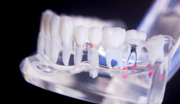 istock Dentists tooth plastic model used for teaching, learning and patient consultations in dental office showing teeth and gums. 846945364