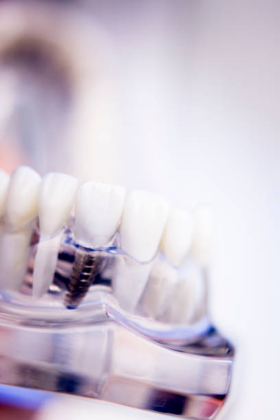 istock Dentists tooth plastic model used for teaching, learning and patient consultations in dental office showing teeth and gums. 846945484
