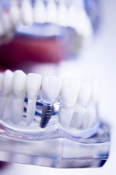istock Dentists tooth plastic model used for teaching, learning and patient consultations in dental office showing teeth and gums. 846945520