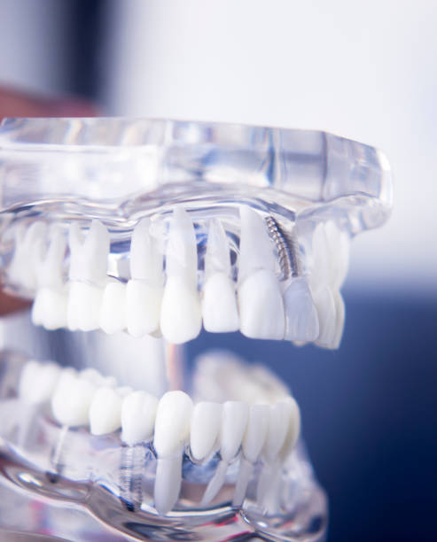 istock Dentists tooth plastic model used for teaching, learning and patient consultations in dental office showing teeth and gums. 846945848