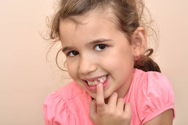 istock Young girl showing a missing tooth 847054258