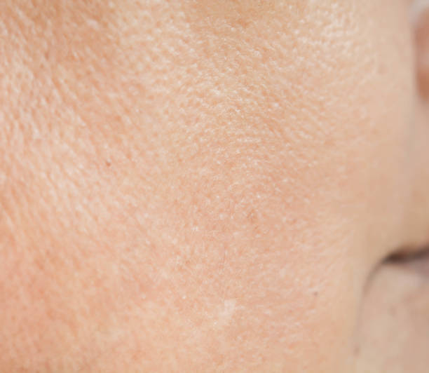 istock Pores on the face in women 847058266