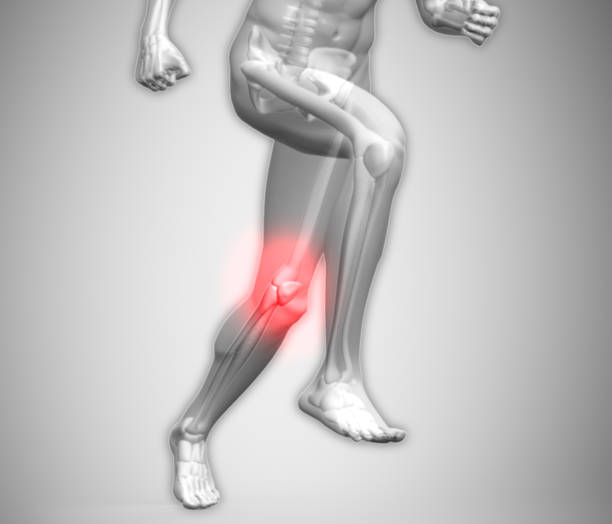 istock Grey human body running with ankle highlighted in red 847100684
