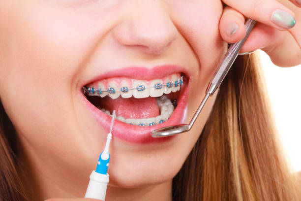 istock Woman with braces having dentist appointment 848111372
