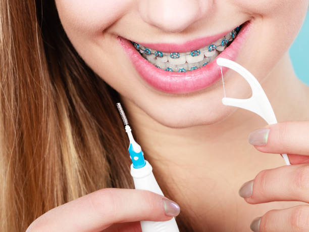 istock Woman with braces cleaning teeth with toothbrush 848118422