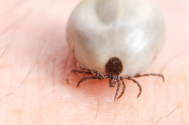 istock Tick filled with blood sitting on human skin 848766148