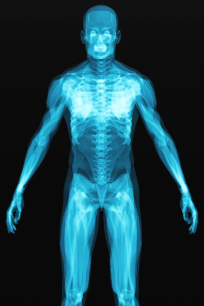 istock X-ray scan of the human body 848909862