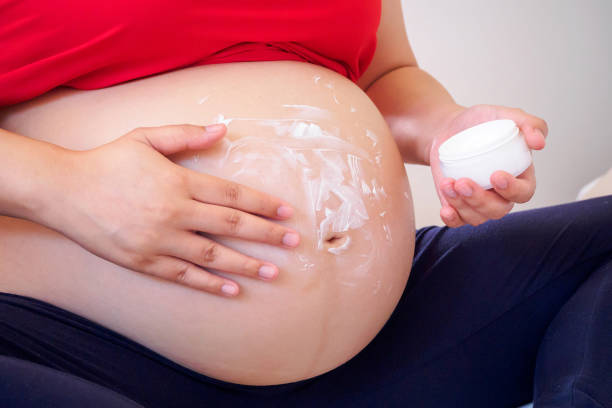istock Pregnant Woman applying stretch marks cream on her belly 848974030