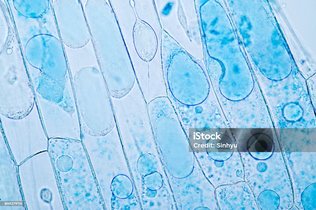Cell structure plant (onion) showing under the microscope classroom education. Microscope Stock Photo