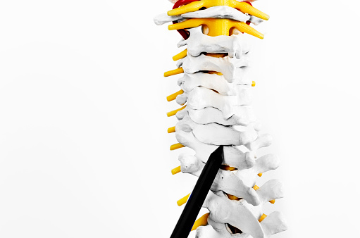 Doctor showing a vertebra in the skeleton. Back pain to a patient in silhouette isolated on white background. Color and black and white.