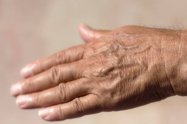 istock Hand of a Senior Man 849320928
