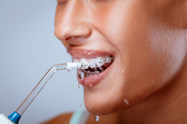 водяной флоссер - brushing teeth human teeth women cleaning стоковые фото и изображения