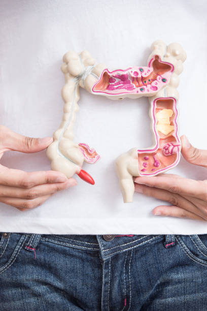 istock woman with colorectal cancer 849617534