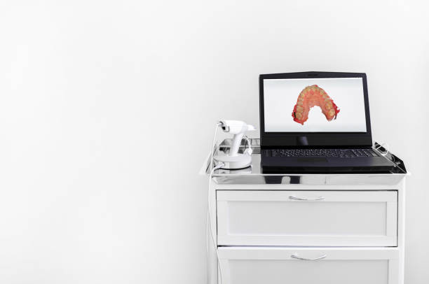 dental 3d scanner y el monitor en la oficina del dentista - machine teeth fotos fotografías e imágenes de stock