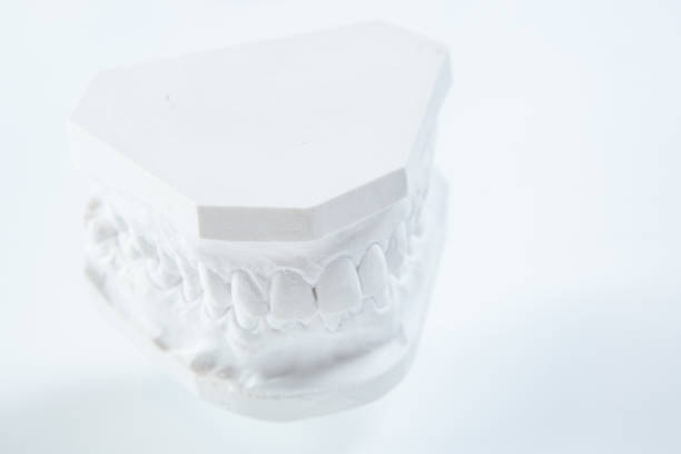 istock Gypsum model of human jaw on a white background. 849836700