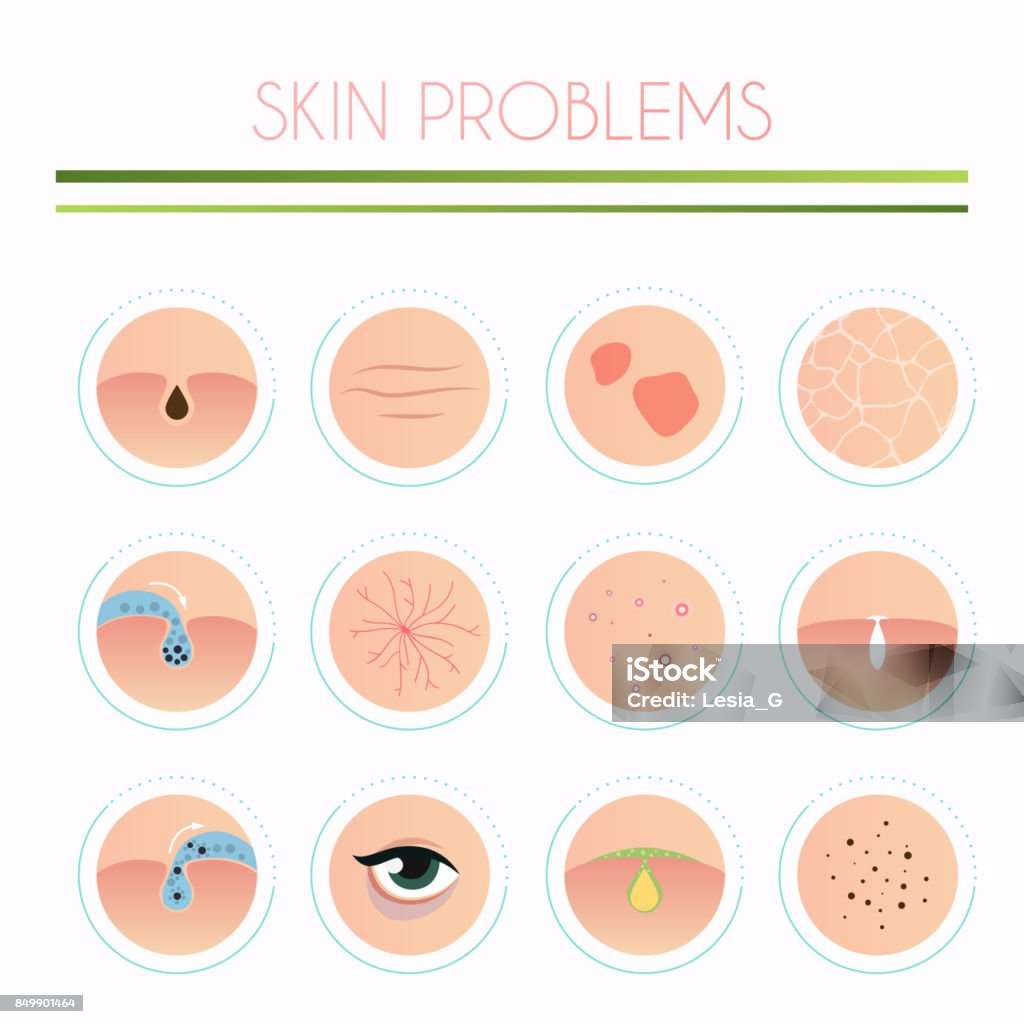 Guide To Skin Issue Skin Problems Solution Home Remedies Skincare And Dermatology Concept ...