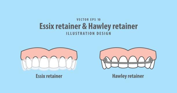 Essix retainer & Hawley retainer illustration vector on blue background. Dental concept. Essix retainer & Hawley retainer illustration vector on blue background. Dental concept. orthodontist stock illustrations