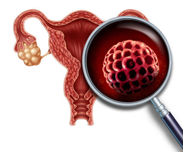 Early Pregancy Blastocyst Early pregnancy blastocyst implanted inside a human uterus as a fertilization medical concept as an implantation and reproductive cell division icon in reproduction representing anatomy fertility success symbol in a 3D illustration. human blastocyst stock pictures, royalty-free photos & images